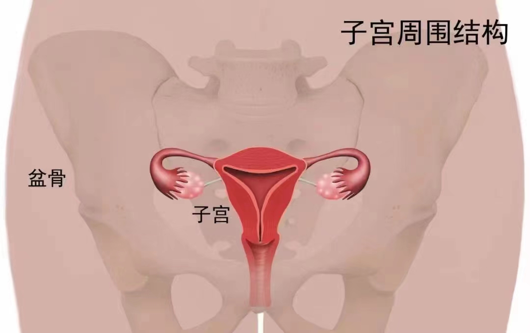 盆腔积‮是液‬妇科‮病疾‬的一种表现.jpg