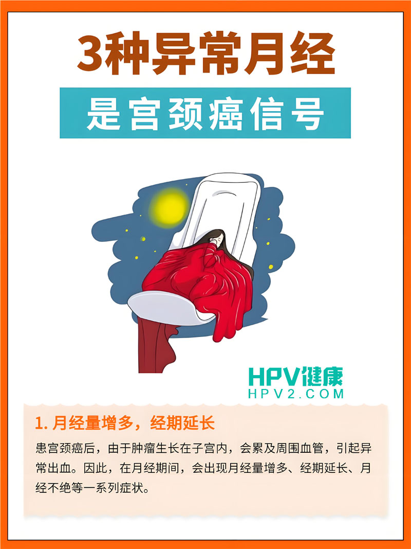 【宫颈癌与月经变化】宫颈癌患者月经会正常吗？.jpg