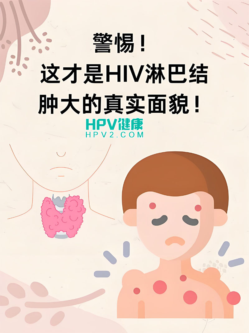宫颈癌淋巴结肿大：是转移信号吗？专家解读.jpg