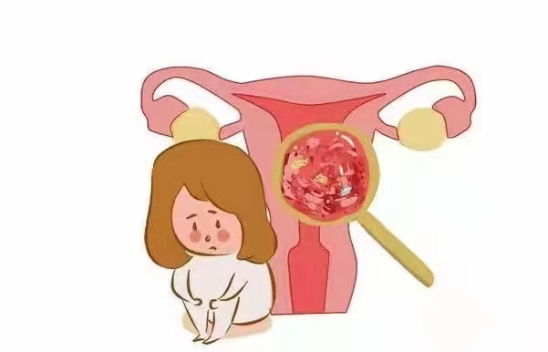 伴侣患有HPV感染另一半有必要做相关检查吗？.jpg