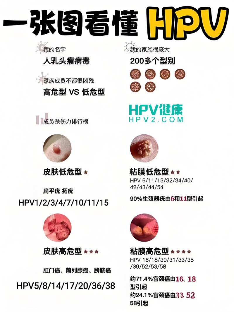 HPV感染严重性解析：高危与低危型别的区别及预防措施.jpg