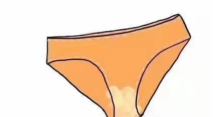 不同的白带都是代表着不同的疾病.jpg