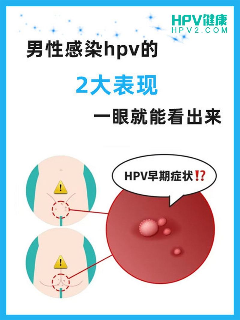 男性HPV感染有什么表现.jpg