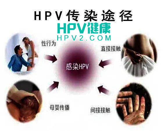 揭秘HPV病毒感染途径：如何有效预防人乳头瘤病毒.jpg