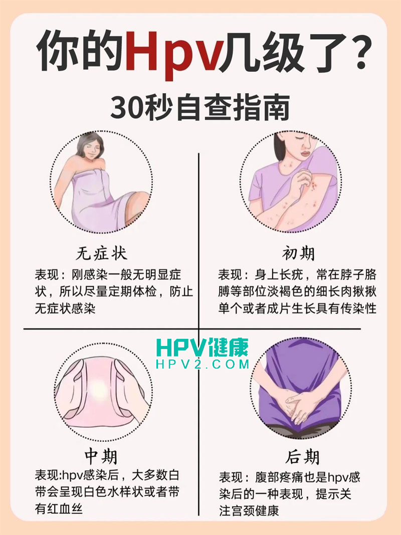女性如何自查HPV感染：10个实用自检方法.jpg