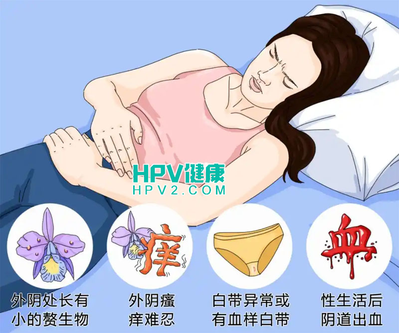 女性感染HPV病毒后的常见症状解析及应对策略.jpg