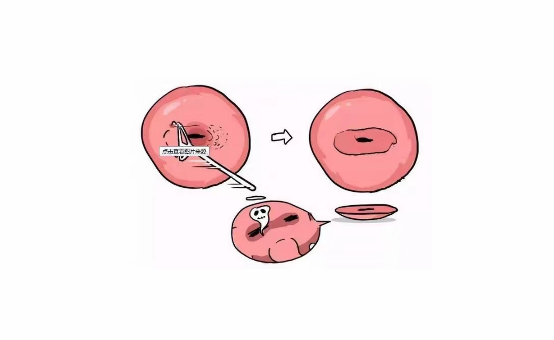 宫颈活检的影响.jpg