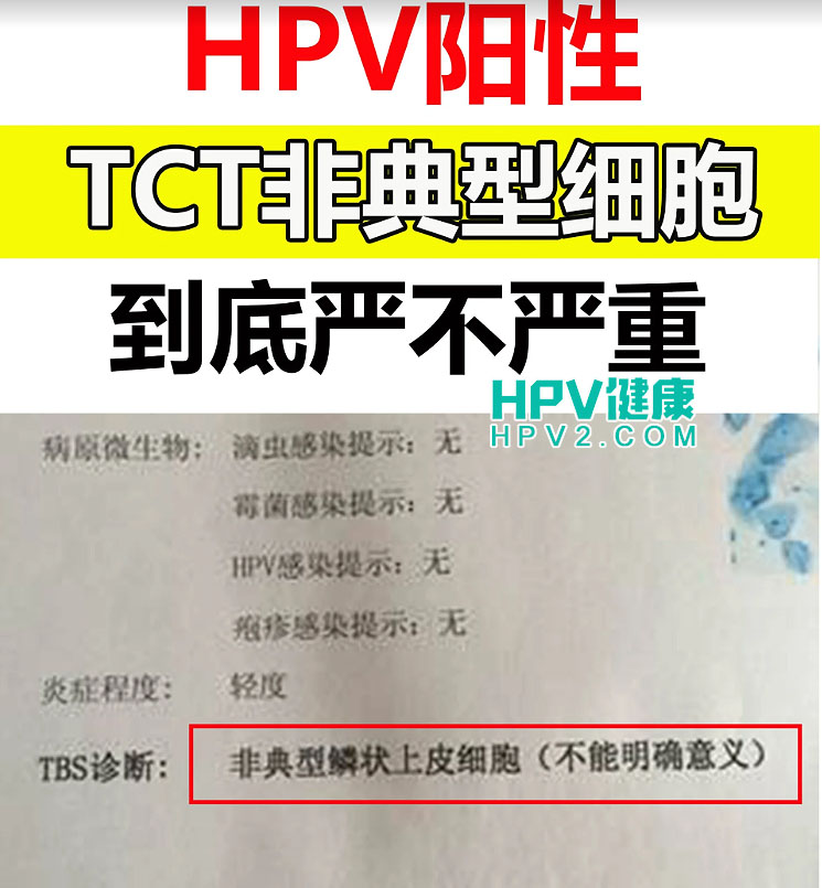 HPV阳性，TCT非典型，到底严不严重.jpg