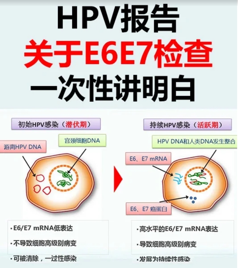 HPV感染E6E7阳性怎么办.png