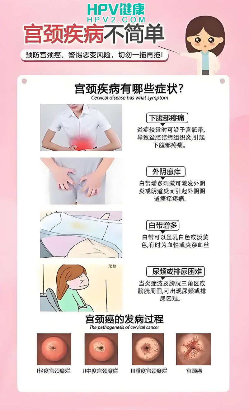 HPV6和11阳性诊断：阴道感染原因与治疗方案.jpg