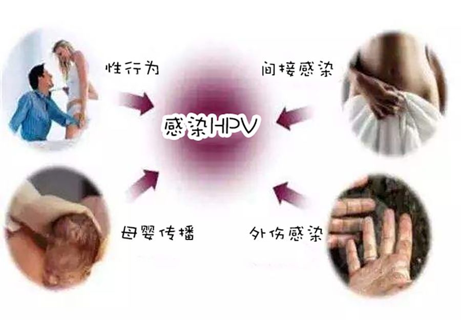 感染HPV病毒后，面临的可能不仅仅是宫颈癌!.jpeg