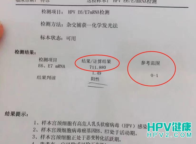 E6E7阳性检查结果解读：转录物数值破万是否意味着癌症？2.jpg