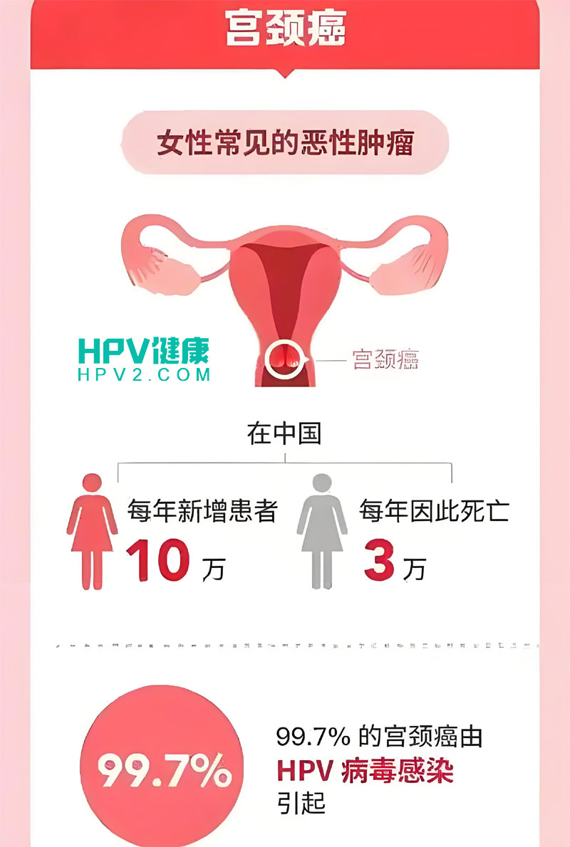 感染HPV是否必然导致宫颈癌？专家这样说.jpg
