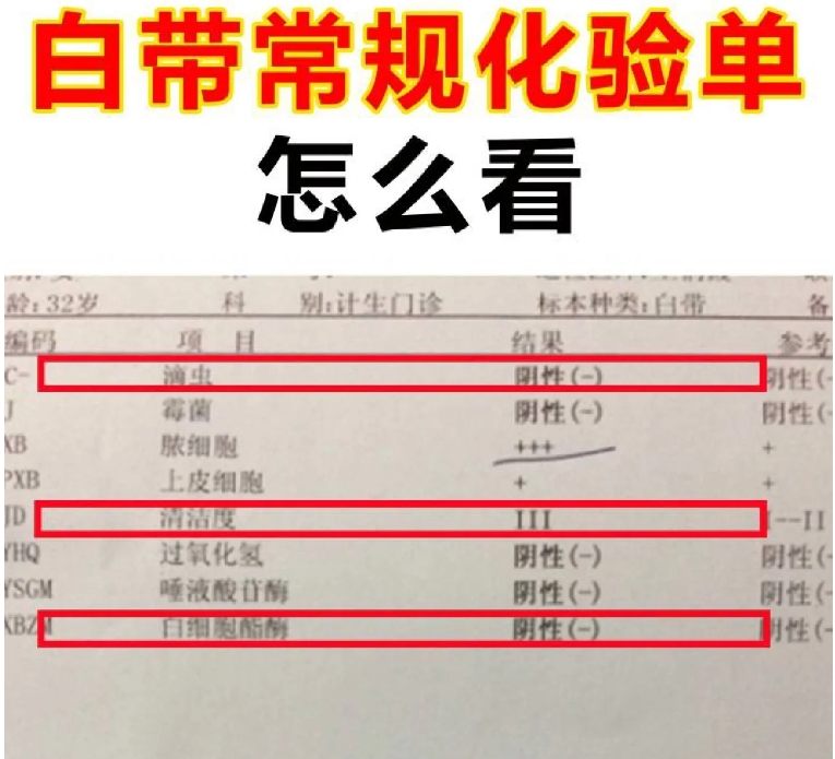 如何看懂白带常规化验单！.png