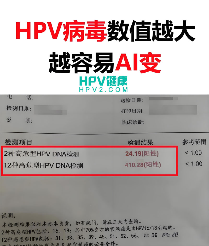 HPV病毒载量与宫颈癌风险：高病毒含量是否意味着更高的癌症风险？.jpg