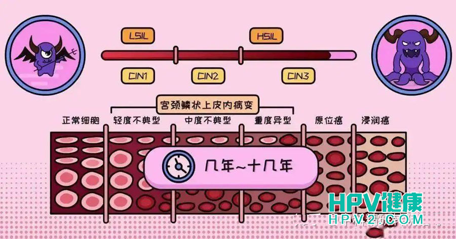 宫颈CIN3是否需要切除子宫？深入了解治疗选择.jpg