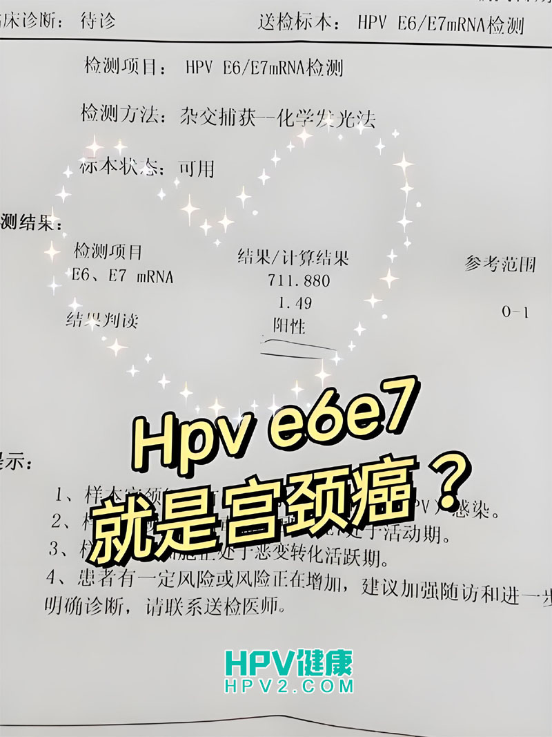 【宫颈健康】TCT正常而E6E7阳性，这是怎么回事？.jpg