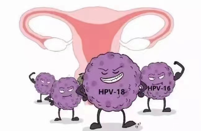 TCT和HPV检测‮确准‬吗？.jpg