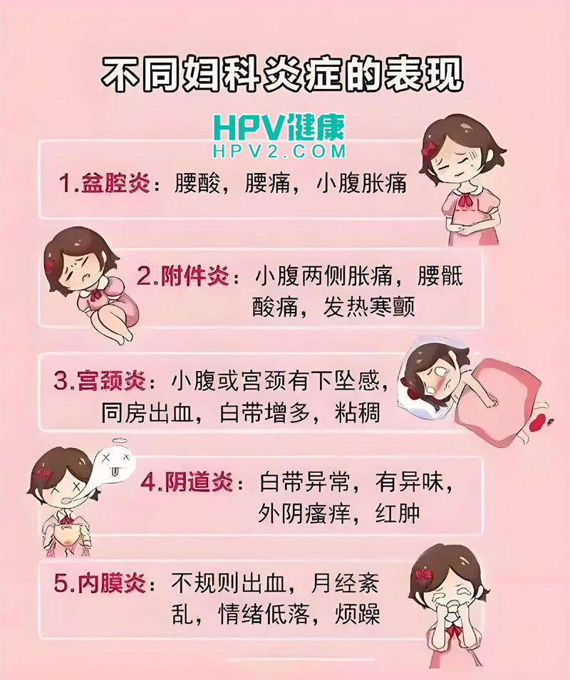 霉菌性阴道炎与宫颈癌的关系：预防措施及定期筛查的重要性.jpg