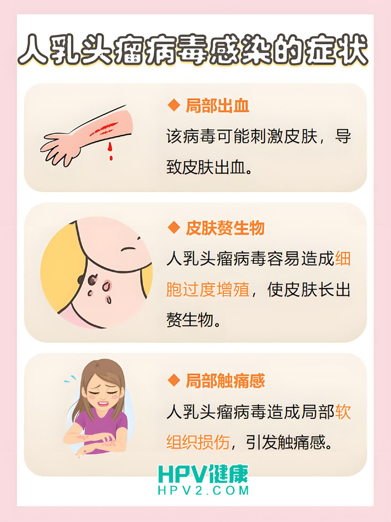 【揭秘HPV】为何有人感染后自愈，有人却发展成严重病变？.jpg