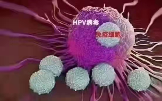 HPV靠锻炼身体提高免疫就可以清除转阴吗.jpg