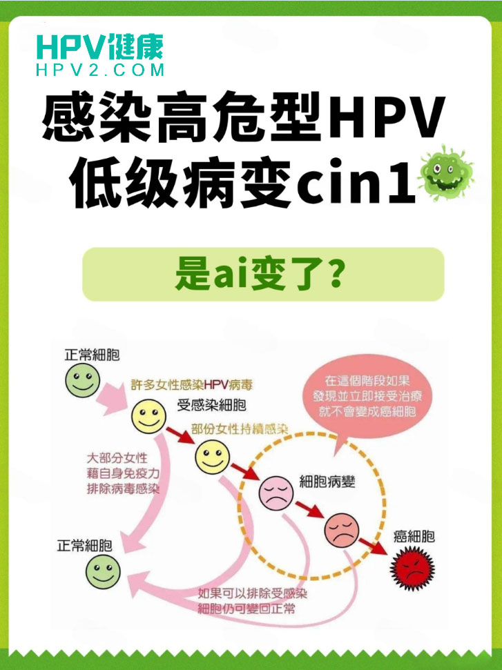 如何有效治疗HPV感染？.jpg