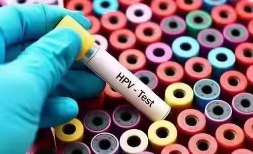 HPV病毒感染有潜伏期吗？.jpg