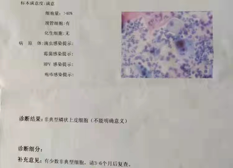 HPV检查中什么是非典型鳞状细胞.jpg