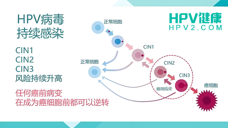 【宫颈健康】宫颈活检与锥切有何不同？揭秘宫颈癌检查的关键步骤.jpg