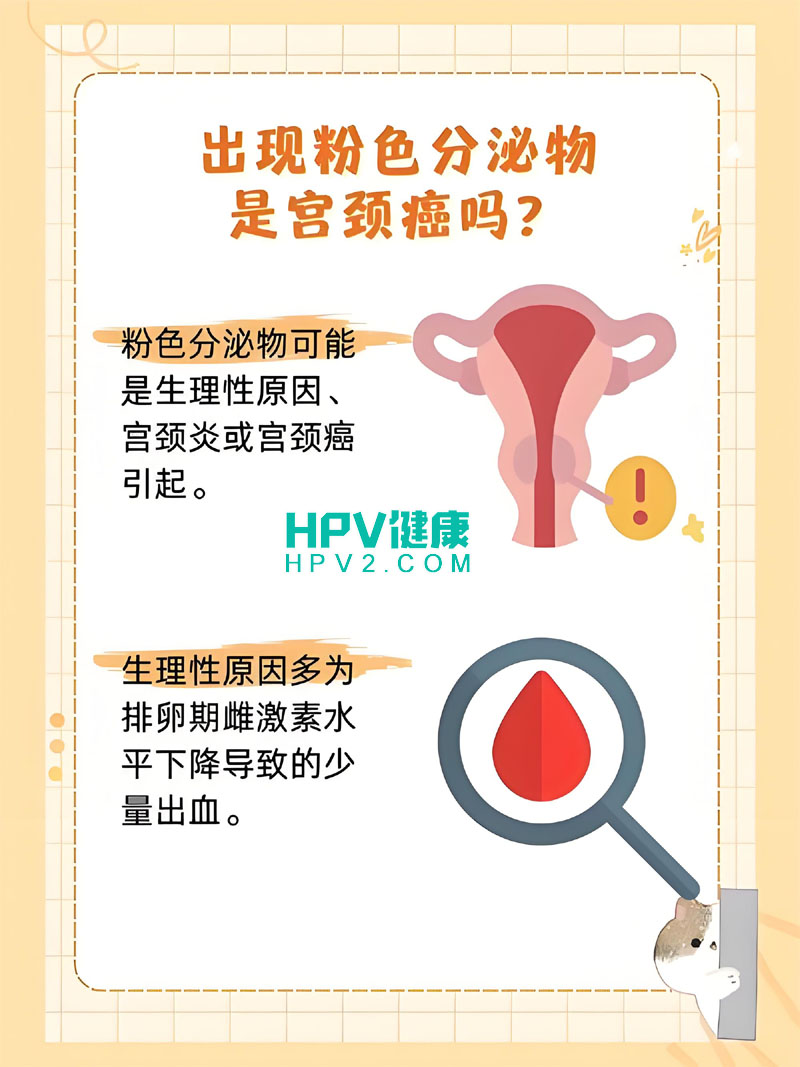 【白带正常宫颈癌风险】了解宫颈癌的隐蔽性及其预防措施.jpg