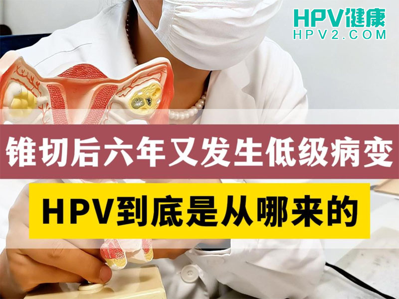 抗HPV蛋白敷料是否有效？答案是肯定的。.jpg
