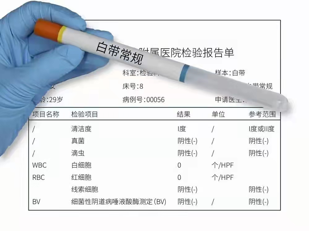 白带常规化验单怎么看.jpg