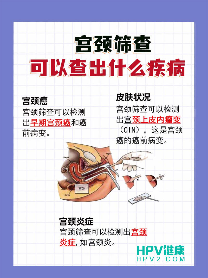 【宫颈癌筛查后出血】正常吗？了解筛查后的注意事项.jpg