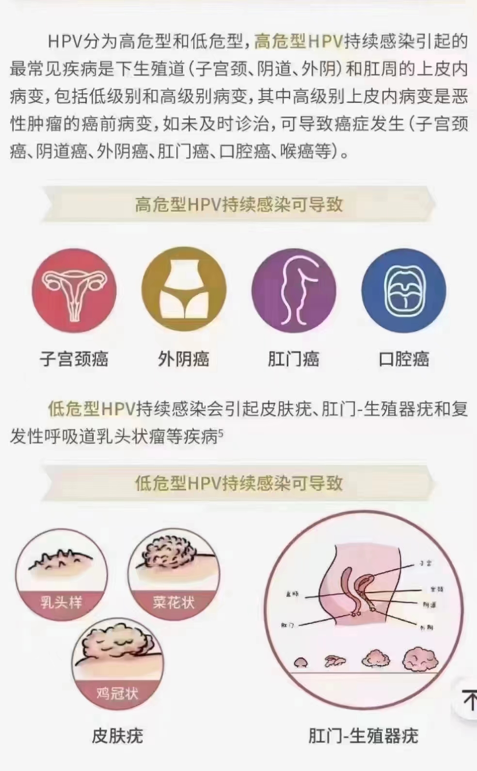 宫颈癌‬‬的三道‭防‬‬线.jpg