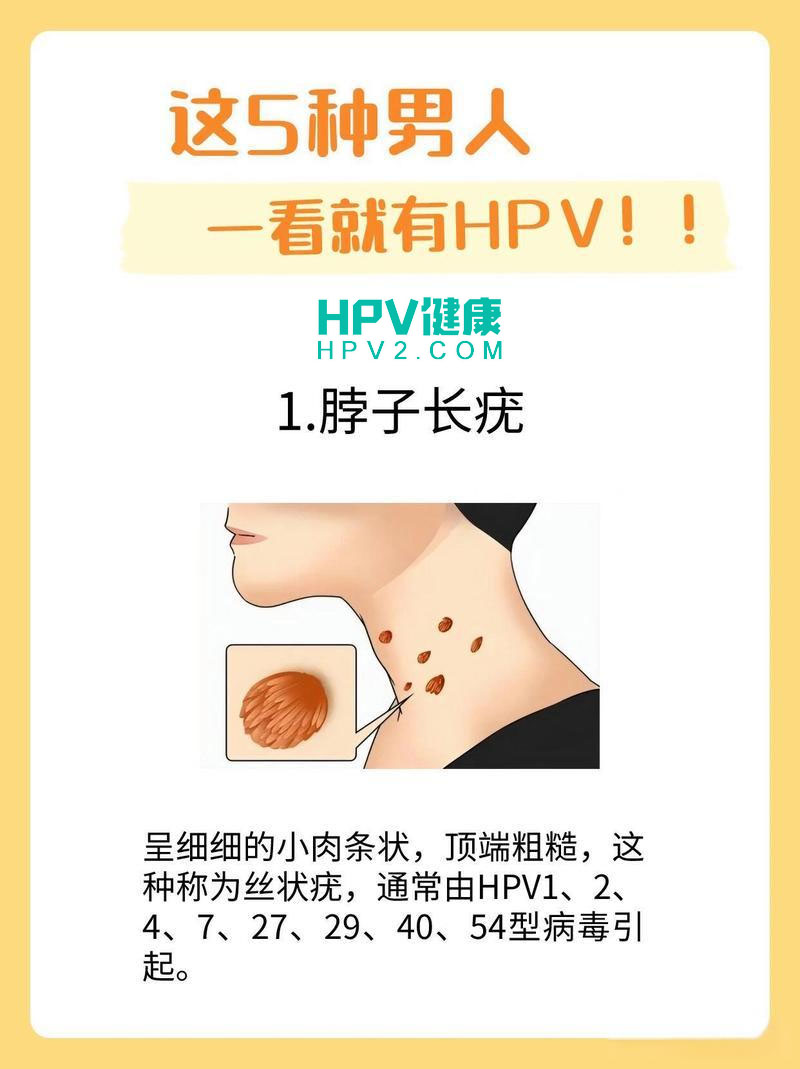 男性感染HPV病毒初期的症状有哪些.jpg