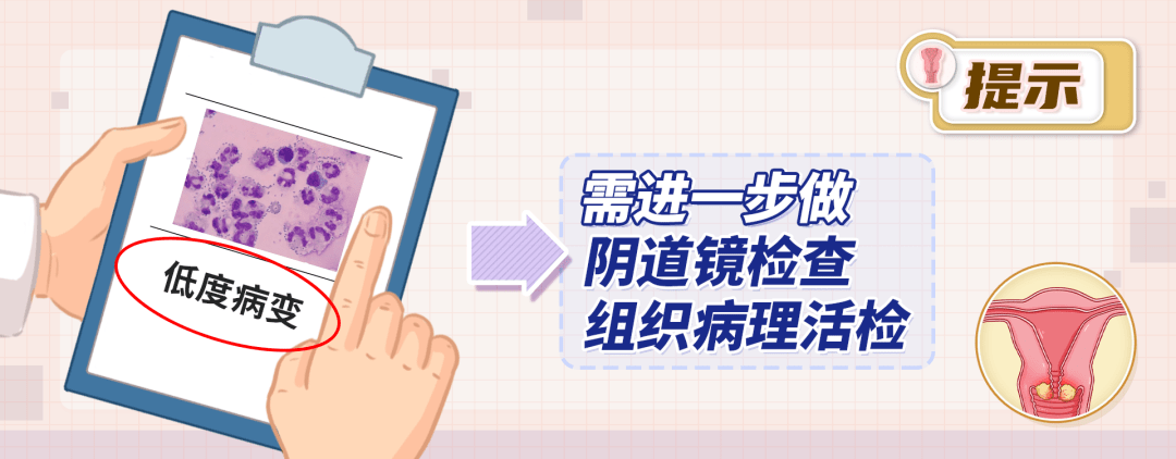 HPV只是筛查 TCT和阴道镜活检 才是诊断.png