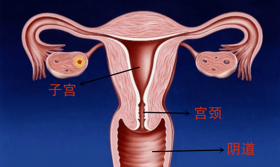早期宫颈癌如何确诊.png